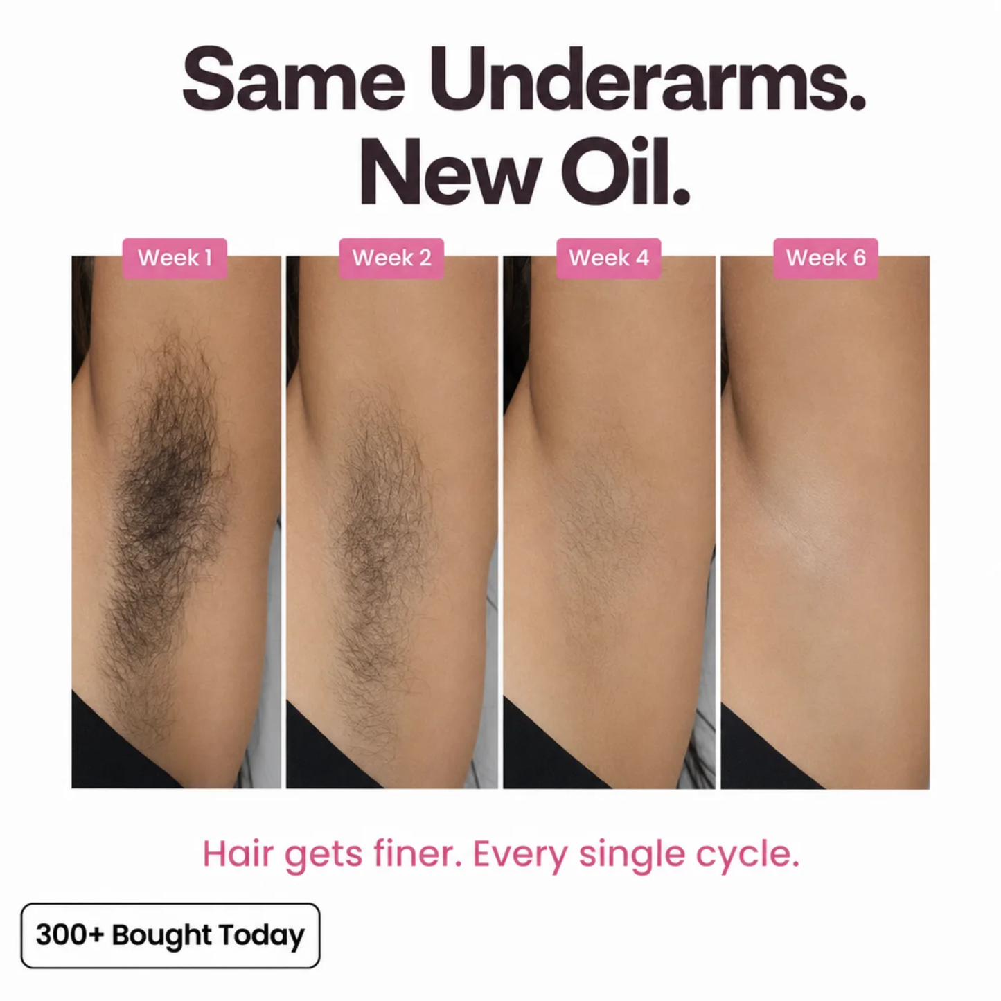 Cyperus Root Hair Reduction Oil