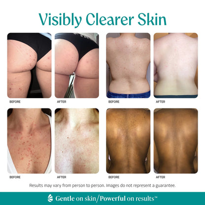 Mandelic Acid Exfoliating Serum