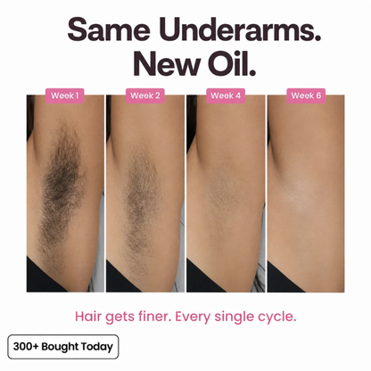 Cyperus Root Hair Reduction Oil