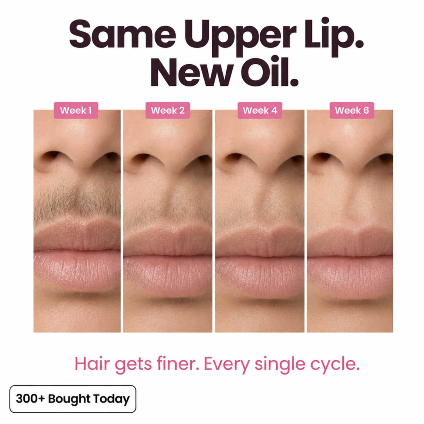 Cyperus Root Hair Reduction Oil