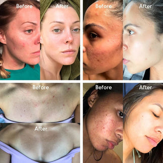 Mandelic Acid Exfoliating Serum