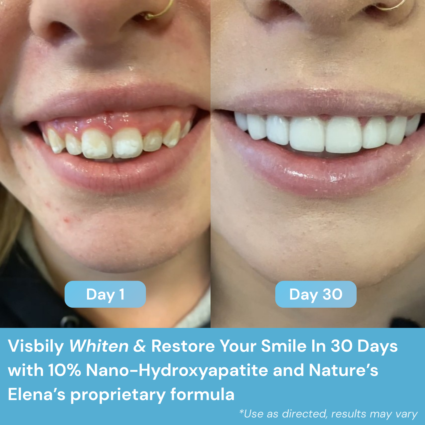 Nature's Elena™ Remineralizing Gum
